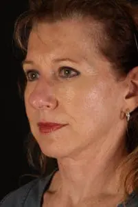 Body by Leverett Before and After Images