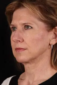 Body by Leverett Before and After Images