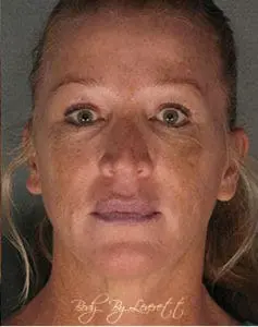 Body by Leverett Before and After Images