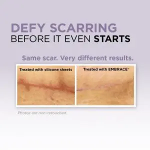 Tummy Tuck in Phoenix, AZ