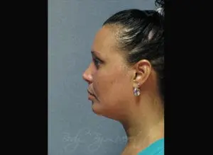 Body by Leverett Before and After Images