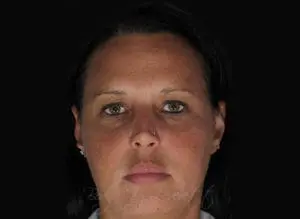 Body by Leverett Before and After Images