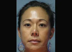 Body by Leverett Before and After Images