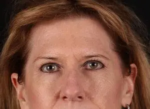 Body by Leverett Before and After Images