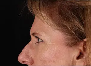 Body by Leverett Before and After Images