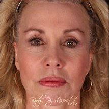 Body by Leverett Before and After Images