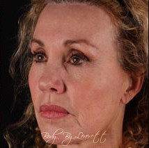 Body by Leverett Before and After Images