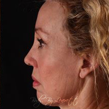 Body by Leverett Before and After Images