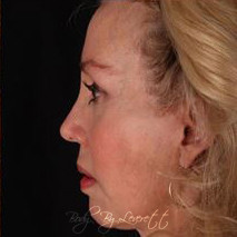 Body by Leverett Before and After Images