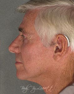Body by Leverett Before and After Images