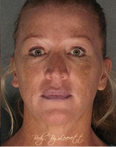 Body by Leverett Before and After Images