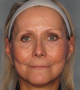 Body by Leverett Before and After Images