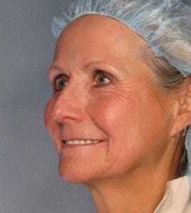 Body by Leverett Before and After Images