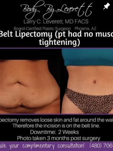 Screen Shot 2021-08-25 at 7.44.15 AM Body by Leverett - Instagram