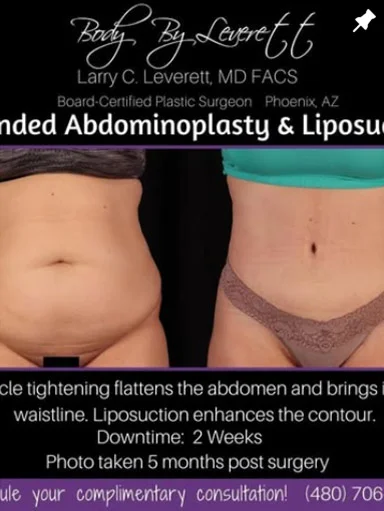 Screen Shot 2021-08-25 at 7.44.20 AM Body by Leverett - Instagram 2