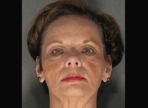 Body by Leverett Before and After Images